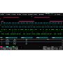 Siglent SDS6000L-I2S I2S trigger & decode (software)