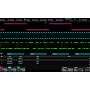 Siglent SDS7000A-I2S  Trigger/Decode, For SDS7000A Oscilloscopes