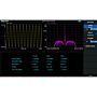 Siglent SSA3000XR-AMA Analog Modulation Analysis: AM, FM